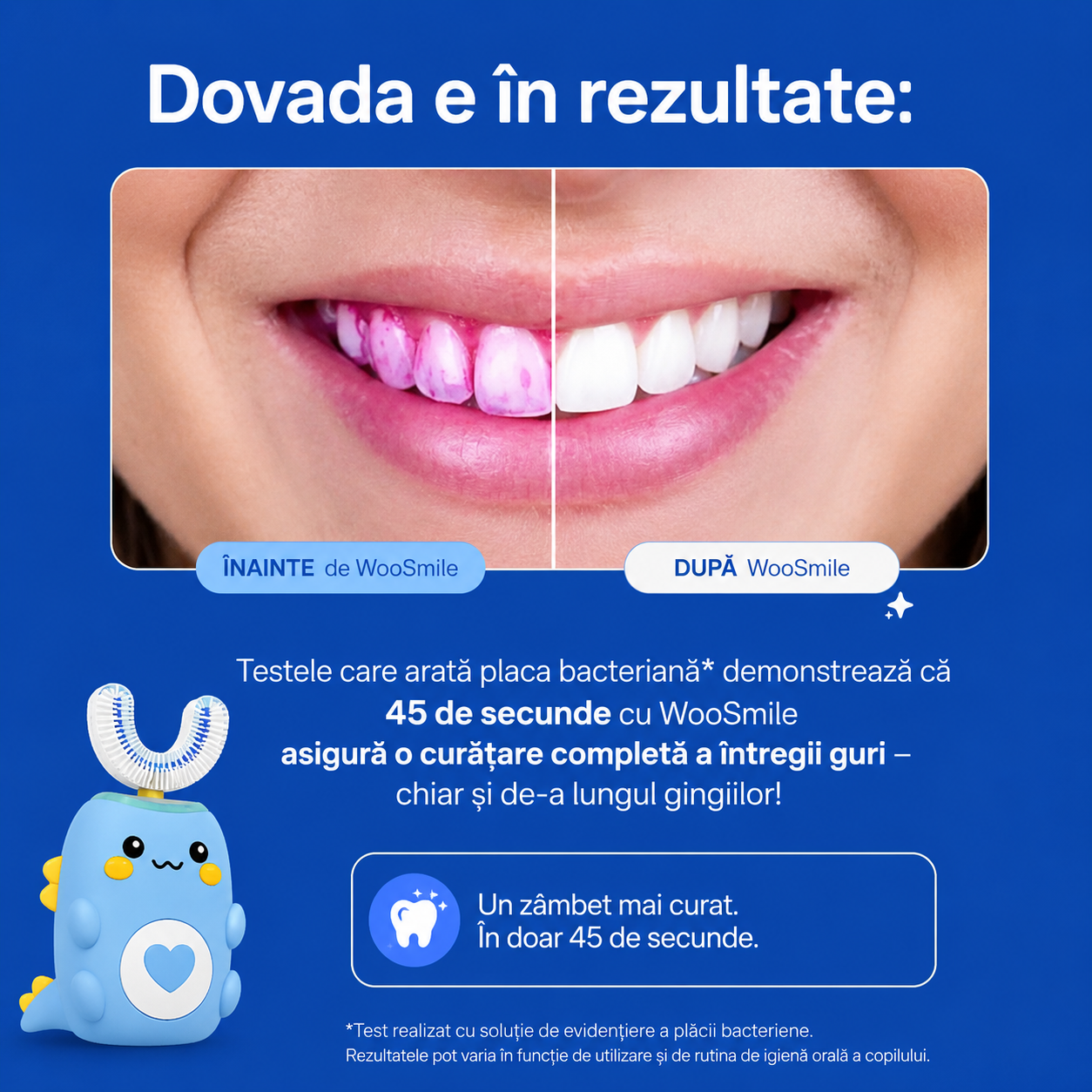 Periuța electrică WooSmile Kids