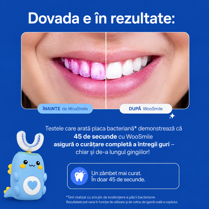 Periuța electrică WooSmile Kids